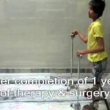 Treatment-for-Paediatric-Disabilities--Orthopaedic-Problems-Trishla-Foundation00a9f70fafc31023