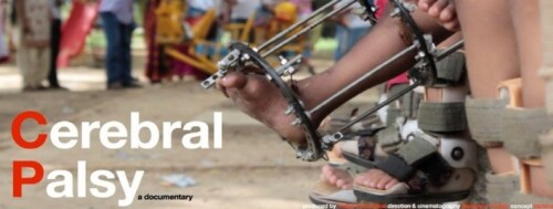 Trishla-Foundation-for-Best-Cerebral-Palsy-Treatment-in-India190a8d1e7aa73918.jpg