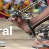 Trishla-Foundation-for-Best-Cerebral-Palsy-Treatment-in-India190a8d1e7aa73918