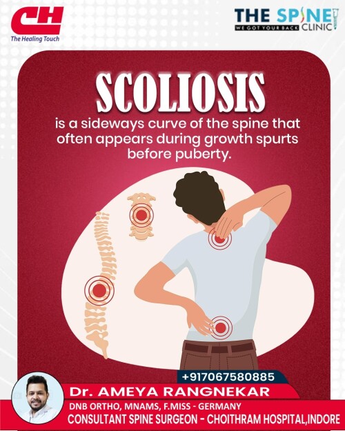 Scoliosis-Correction-in-Indore-Dr-Ameya-Rangnekar3f5a785506d948c2.jpg