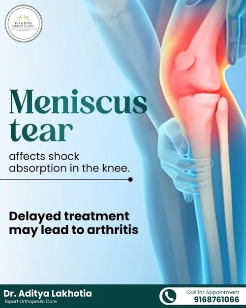 The-Impact-of-Meniscus-Tears-on-Knee-Health-and-Shock-Absorption95b8087a4ba67851.jpg